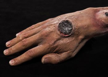 Nigerian government alerts public on outbreak of Anthrax