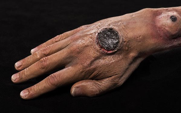Nigerian government alerts public on outbreak of Anthrax